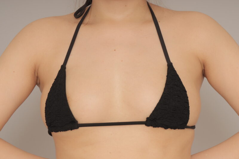 授乳後ママのコンデンスリッチ豊胸♪　モニター様の3か月経過をご紹介♪　34歳 157cm 53kg