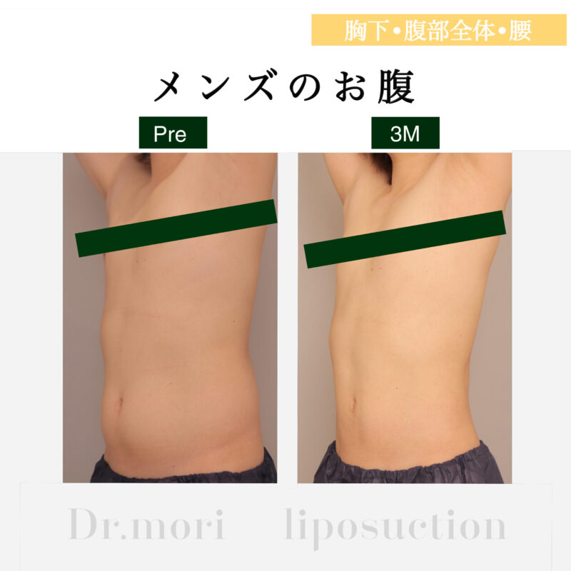 男性のお腹を美しく
