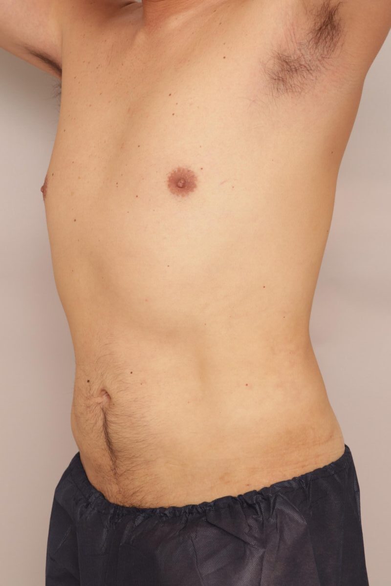 男性の腹部脂肪も効果抜群です