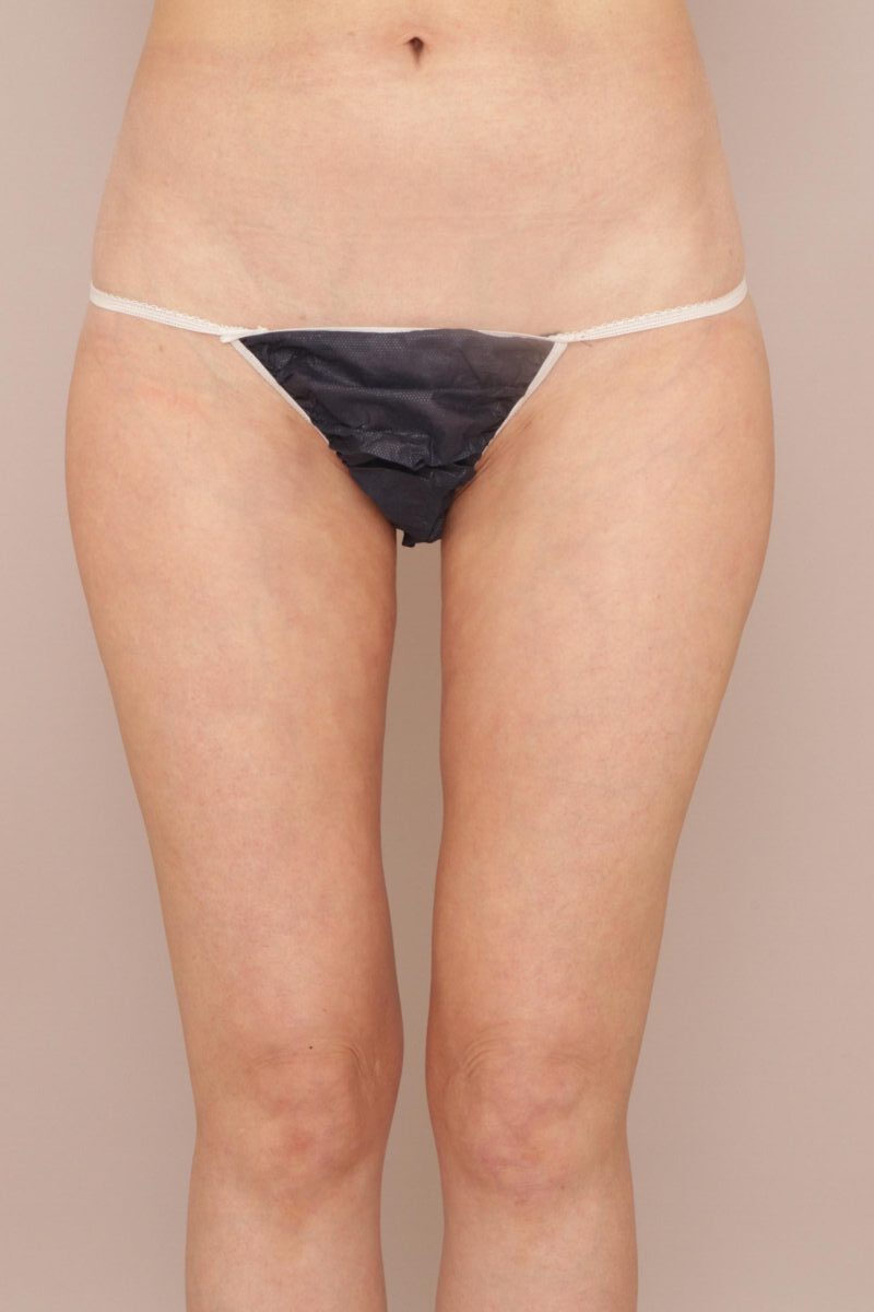 理想の美脚を実現