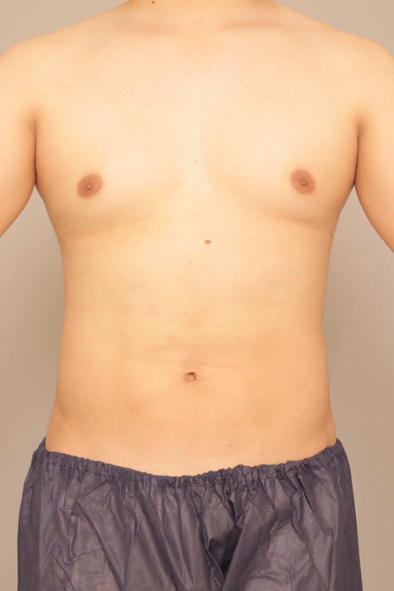1ヶ月後、29歳、BMI 26