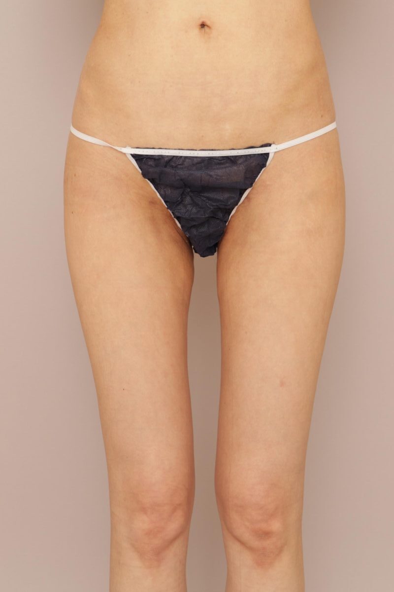 さらに細い美脚を手に入れるには