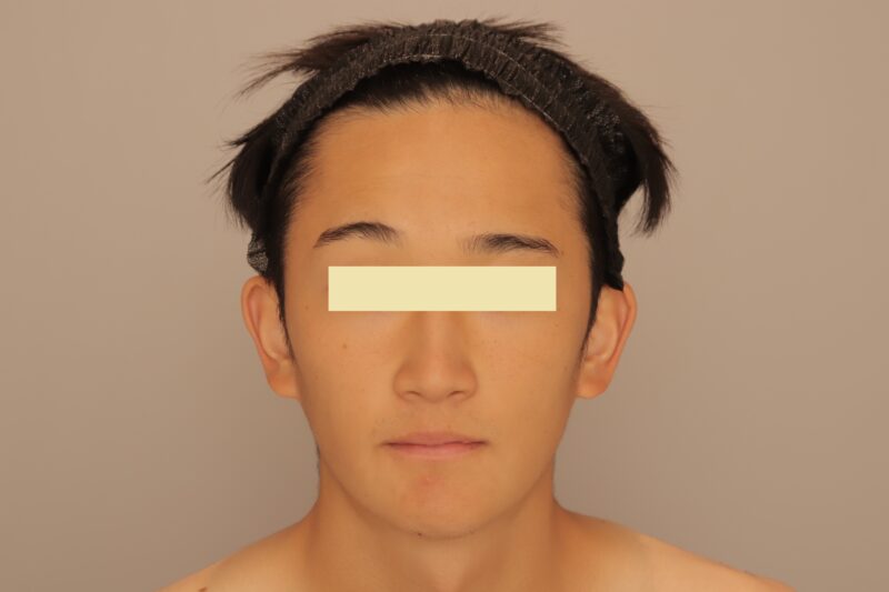 ★男性のお顔の施術はとっても人気です！