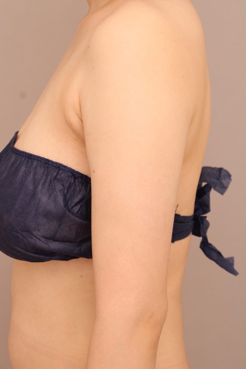 腕を閉じて横から見た際も細く綺麗なシルエットの腕に！