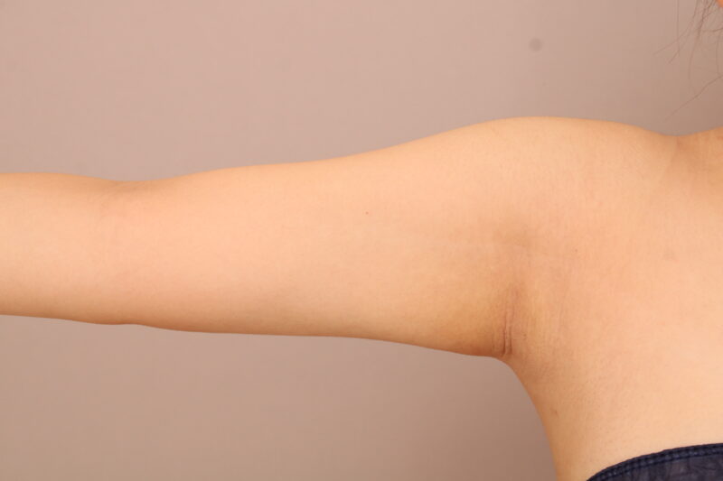 腕を閉じた際にも細く綺麗なシルエットの二の腕に！