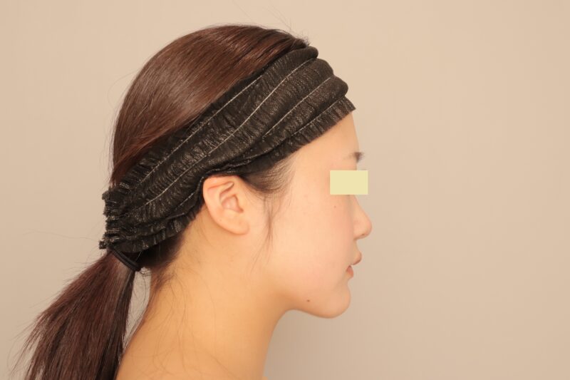 ★糸はしたくない！けど、しっかりシュッとさせたい！