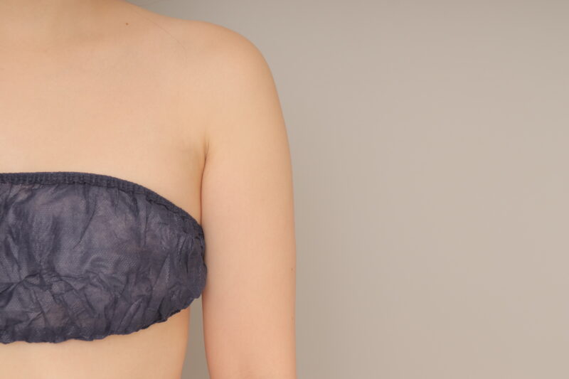 二の腕＋脇肉ですっきり！　モニター様の1か月経過をご紹介♪　35歳 158cm 54kg