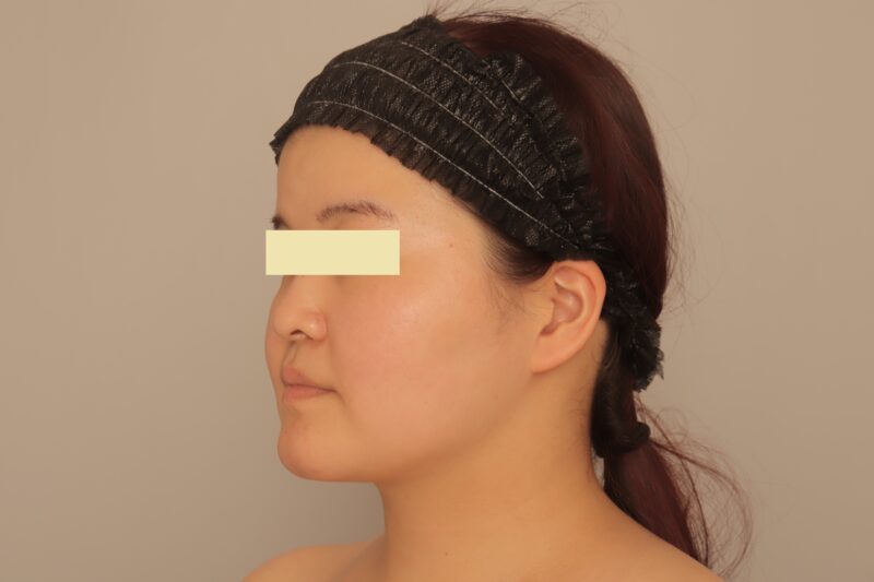 ★フェイスラインしっかり出したい!