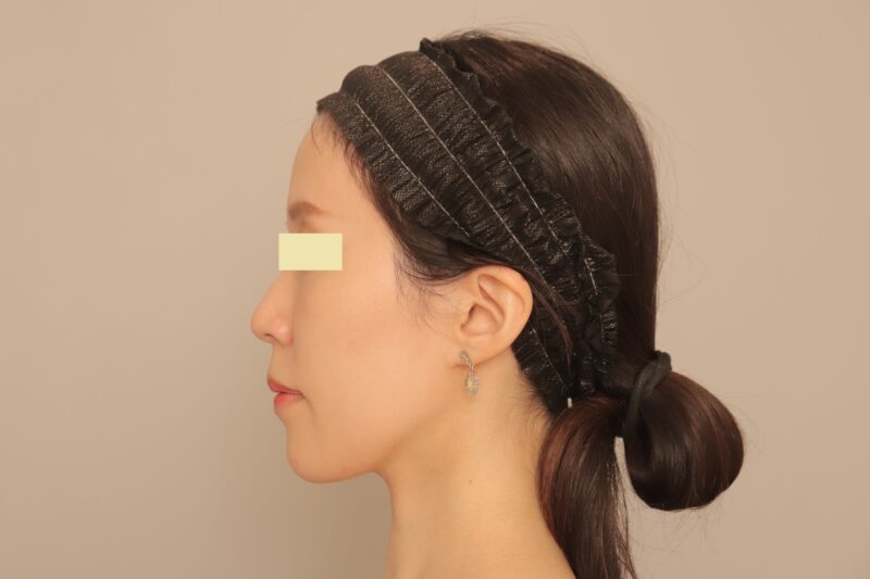 ★さらに小顔に