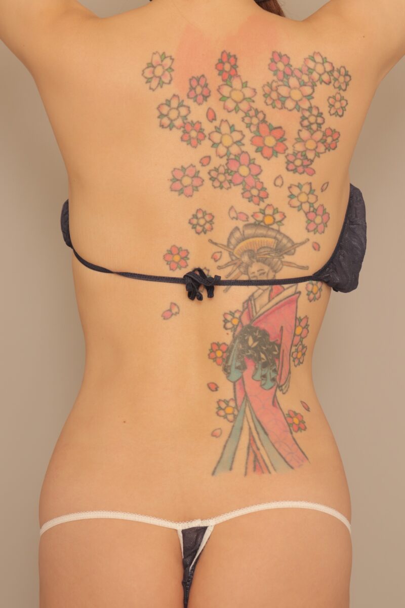 みんなで目指そう峰不二子♡お腹全体胸下腰の脂肪吸引3ヶ月後♫