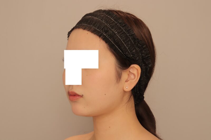 1ヶ月後、19歳、BMI19