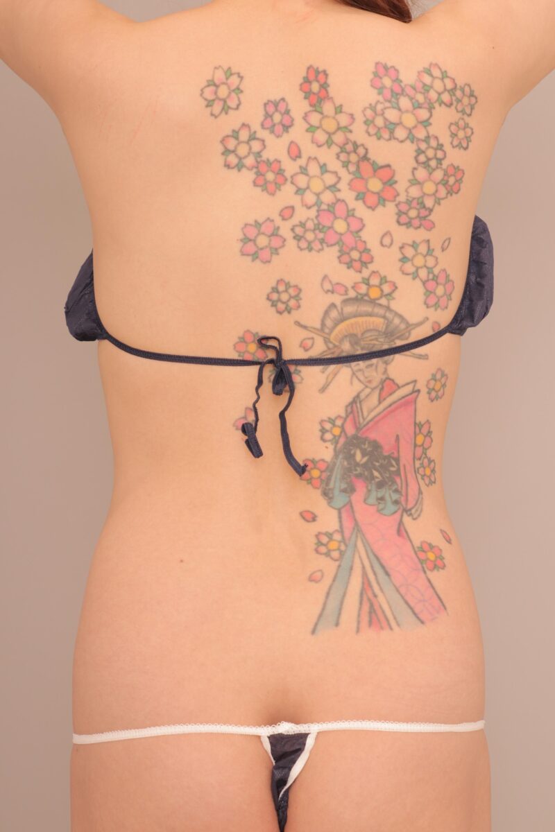 ベイザー脂肪吸引(3か月後経過:36)の術前写真