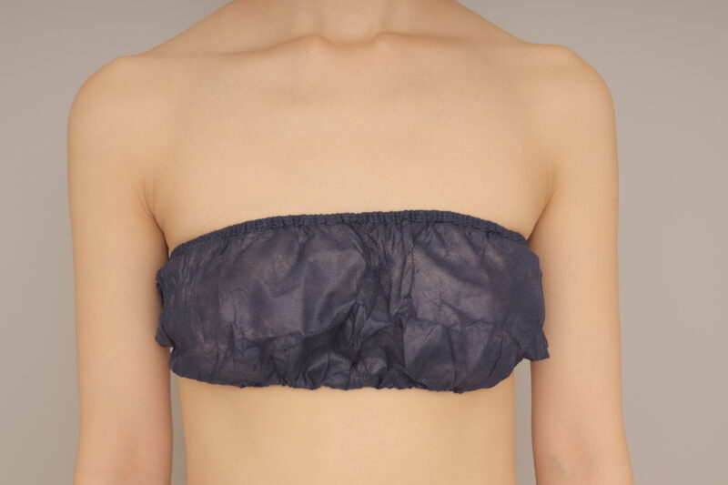 ベイザー脂肪吸引（6か月経過：27）の術後写真