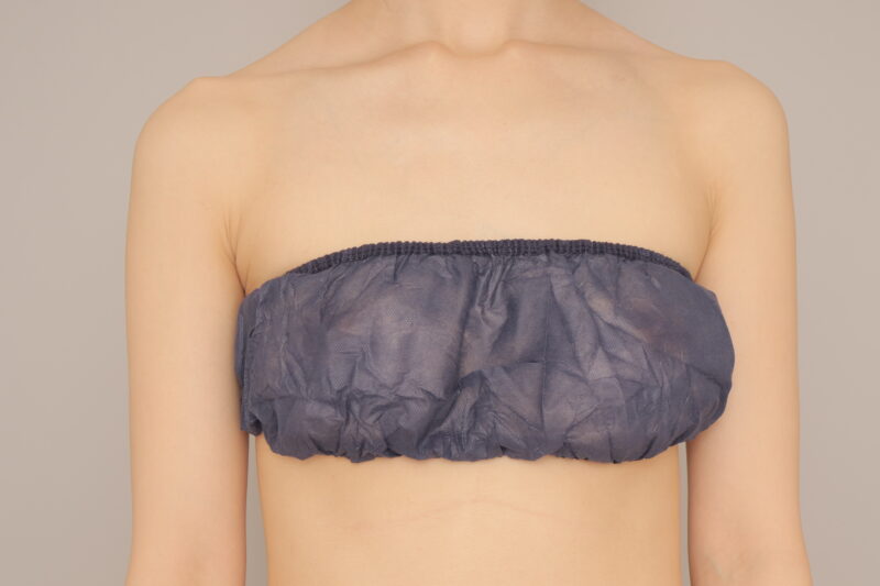 ベイザー脂肪吸引（6か月経過：27）の術前写真