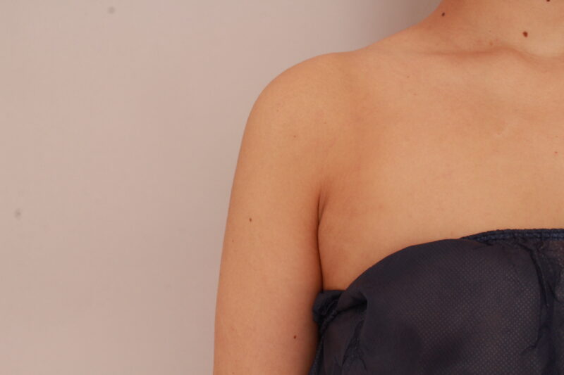 【骨格ストレート】二の腕の外張りも効果的にストンと直線的に！