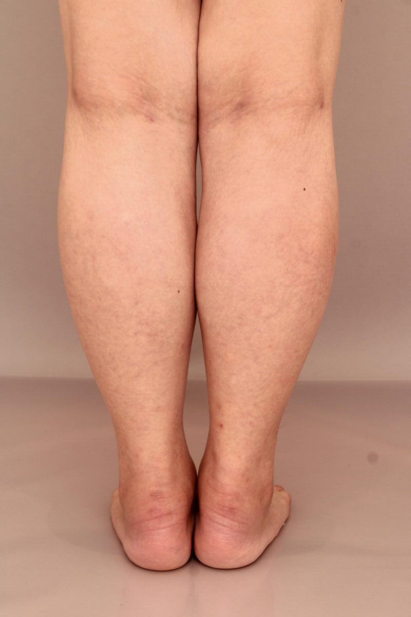 ふくらはぎもすっきりシルエットに！