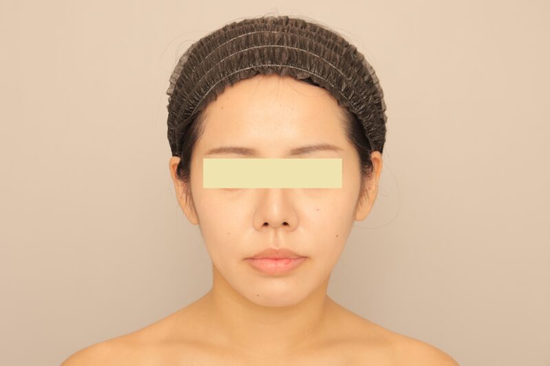 何したかわからないけど、垢抜けた