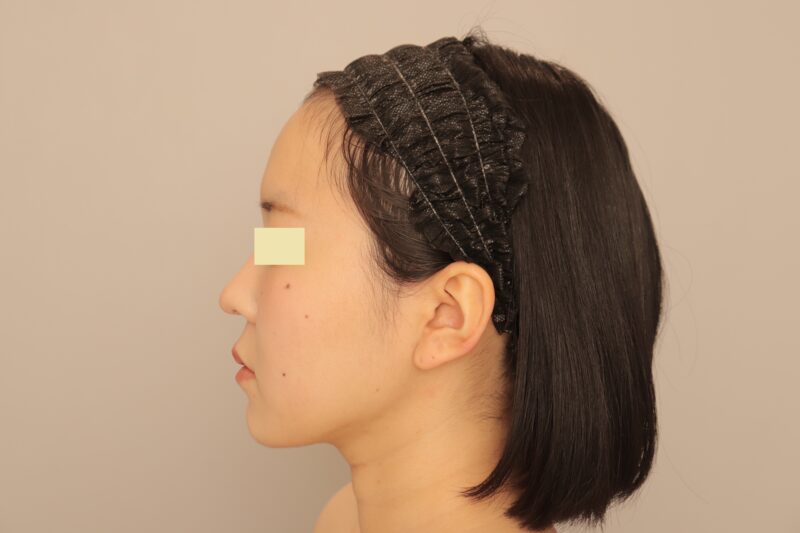 ★翌日からスッキリしてた！