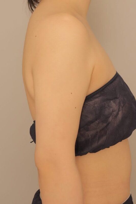 3ヶ月後、24歳、BMI23