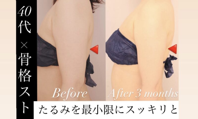 【40代後半×骨格ストレート】皮膚のたるみを最大限出さないデザインがポイント！