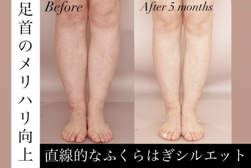 【直線的なふくらはぎシルエット】膝から足首にかけて真っ直ぐな美しいシルエットに！