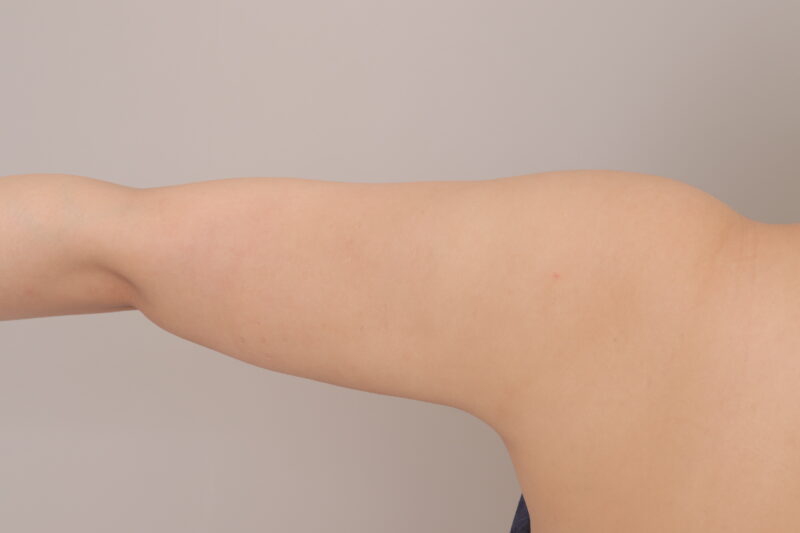 上半身が別人に（腕）