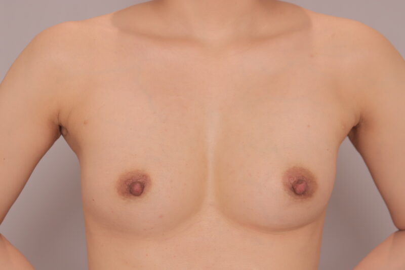 ママさんのコンデンスリッチ豊胸♡目指せ産前よりキレイ！！