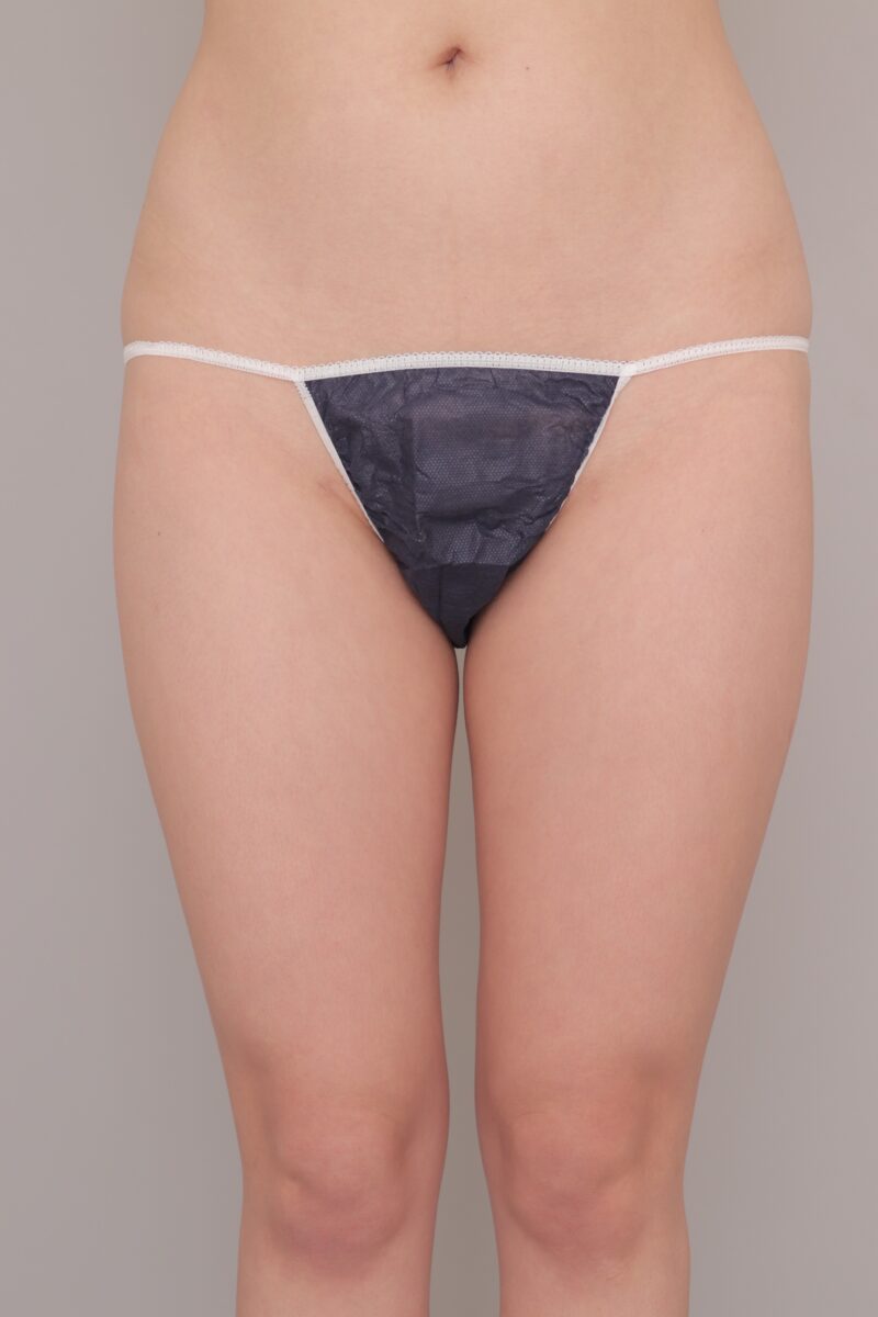 ベイザー脂肪吸引(1ヶ月経過:23)の術前写真