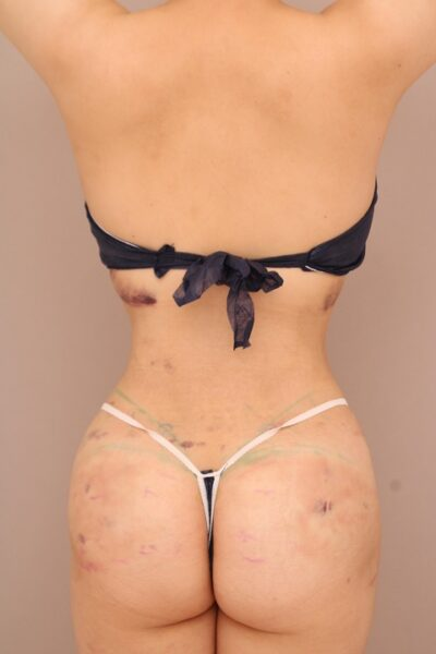 ブラジリアンヒップリフト