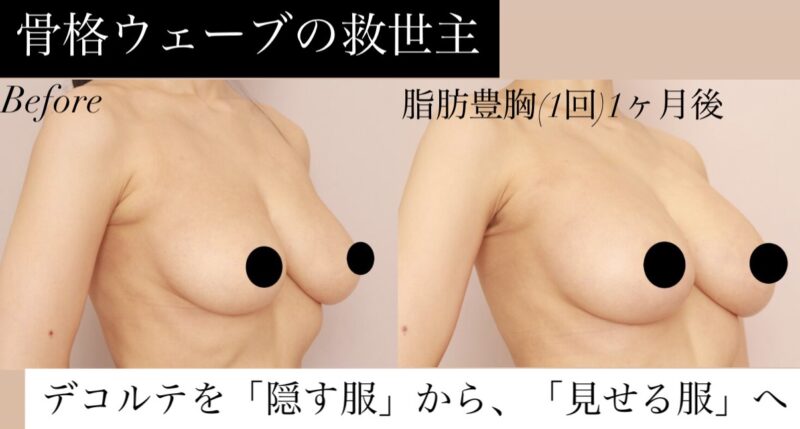 【骨格ウェーブの救世主!】デコルテを「隠す服」から「見せる服」へ、ファッションがもっと楽しく