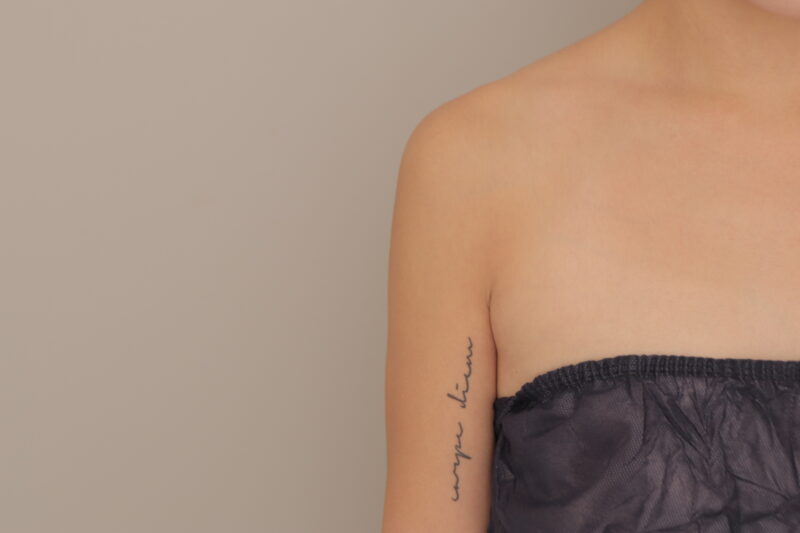 ベイザー脂肪吸引（3ヶ月経過：30）の術後写真