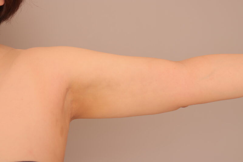 2ヶ月後、48歳、BMI 36