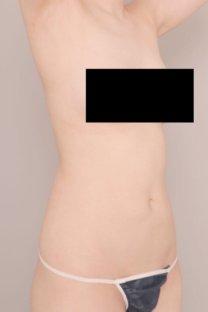 術前