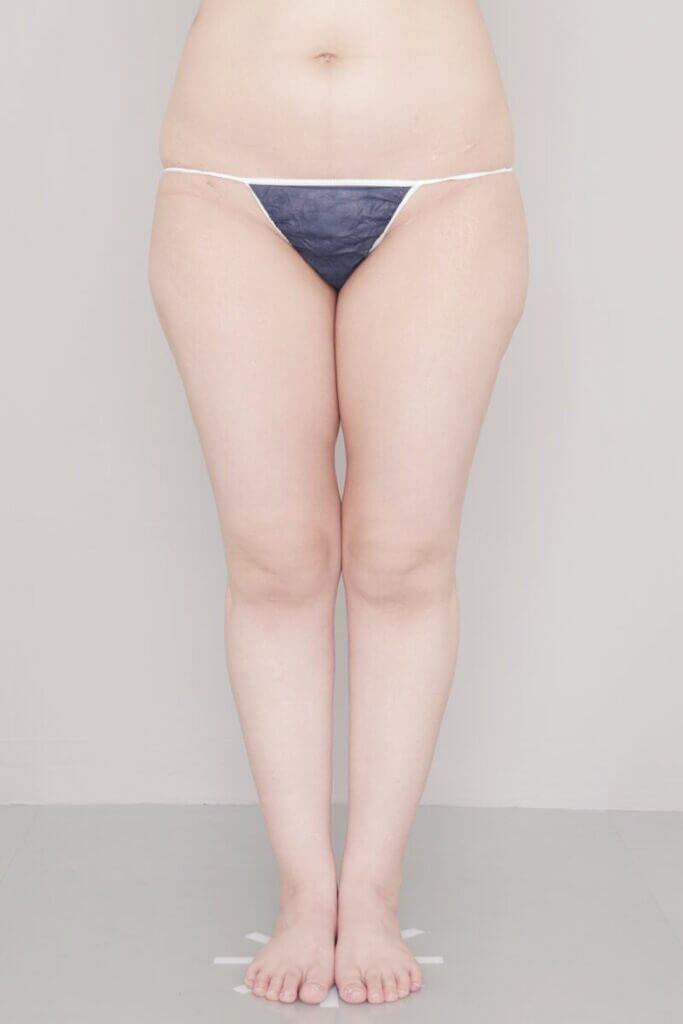 術前
