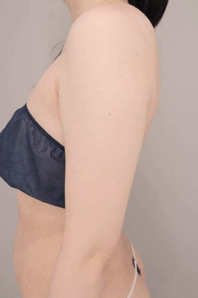 術前