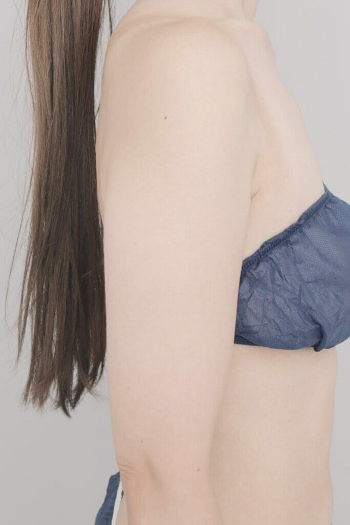 術前