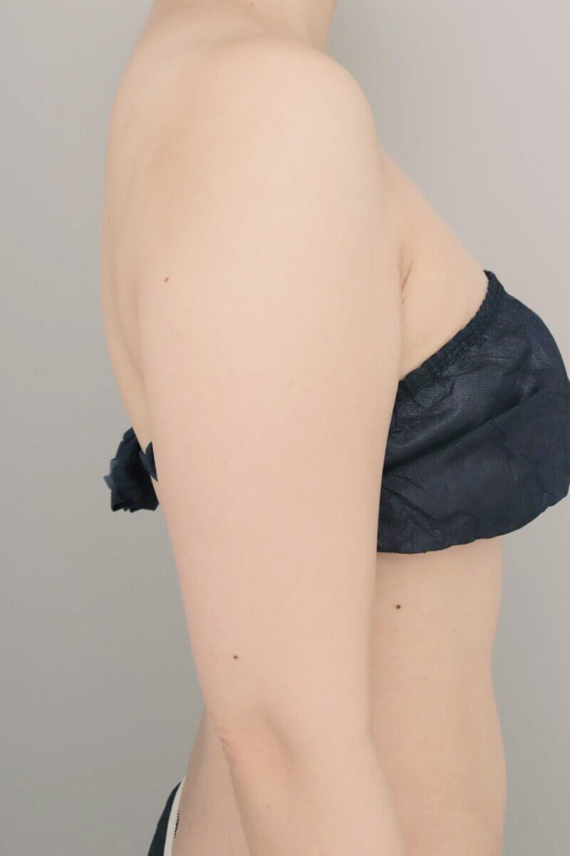 術前