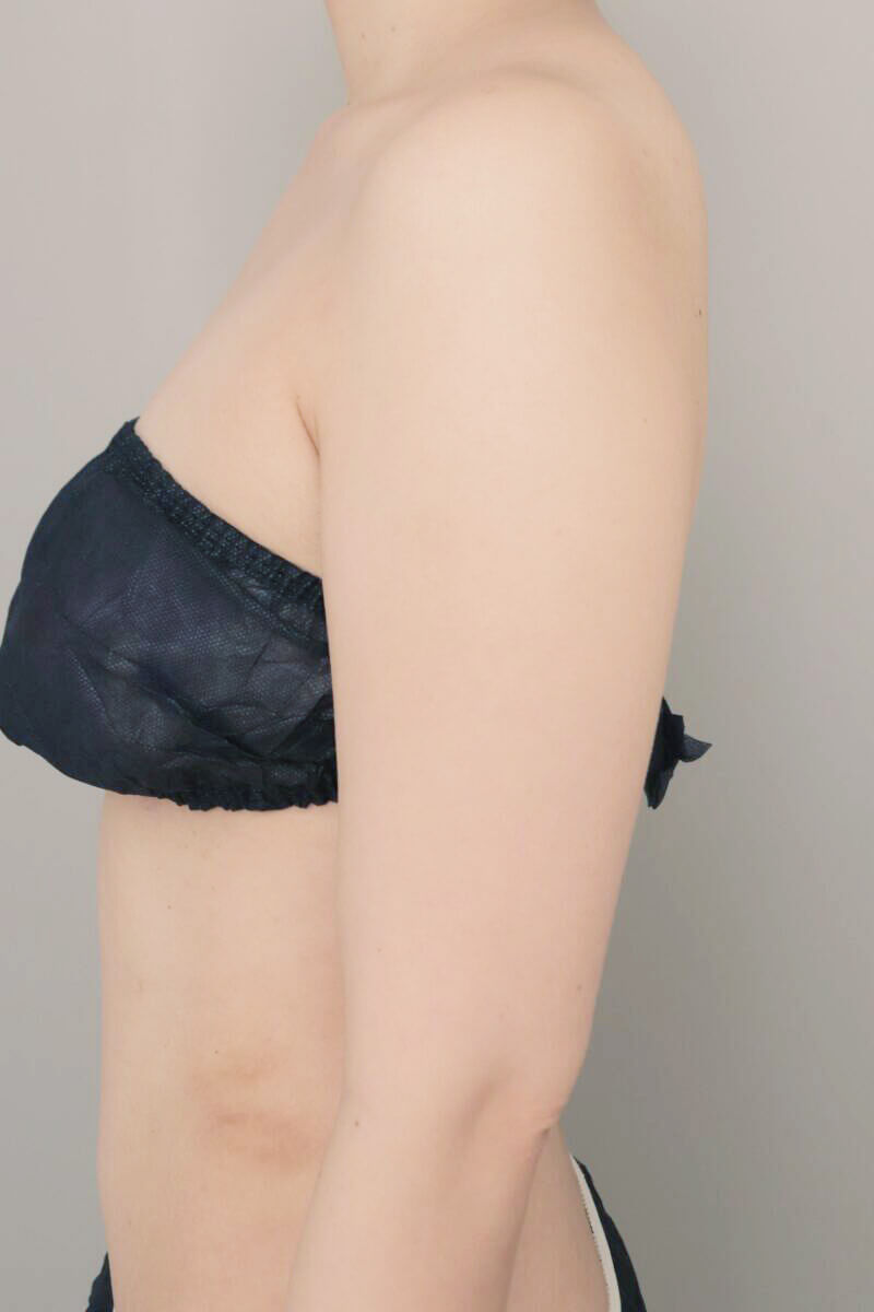 術前