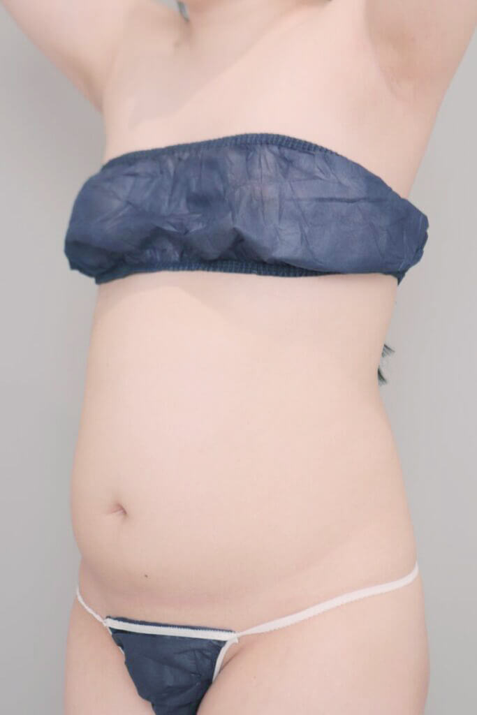 術前