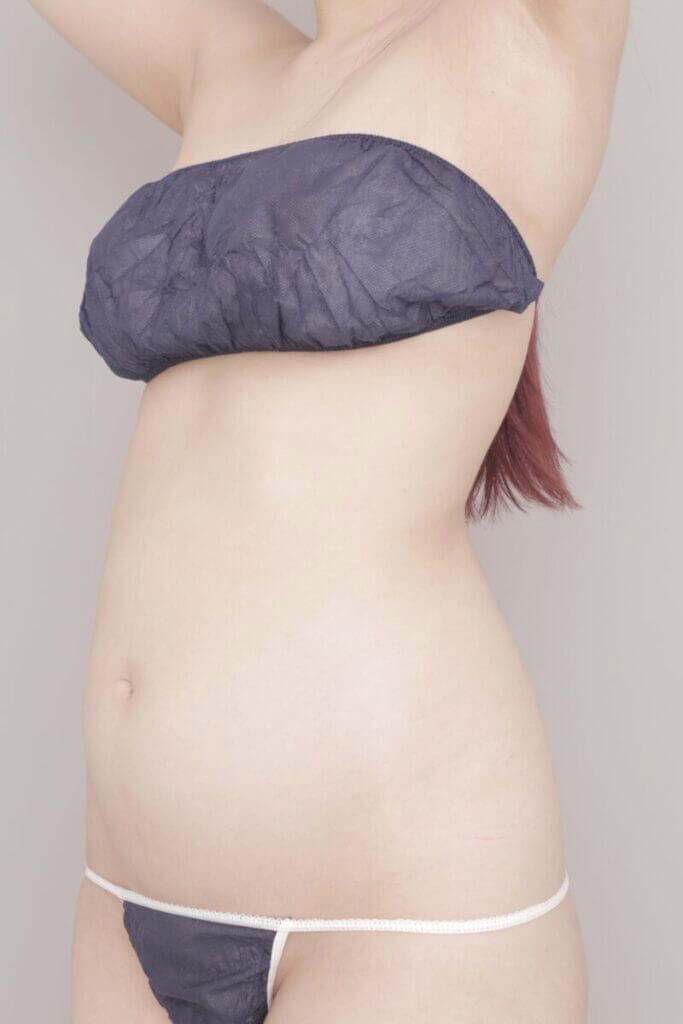 術前