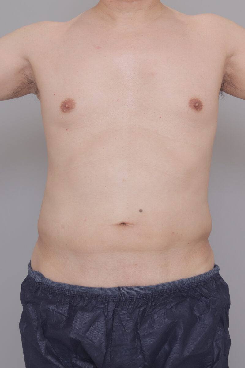 50代男性のウエストまわり激変！（3ヶ月）