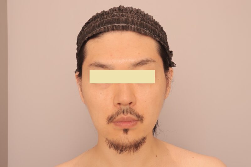 ★骨切級の大変化！