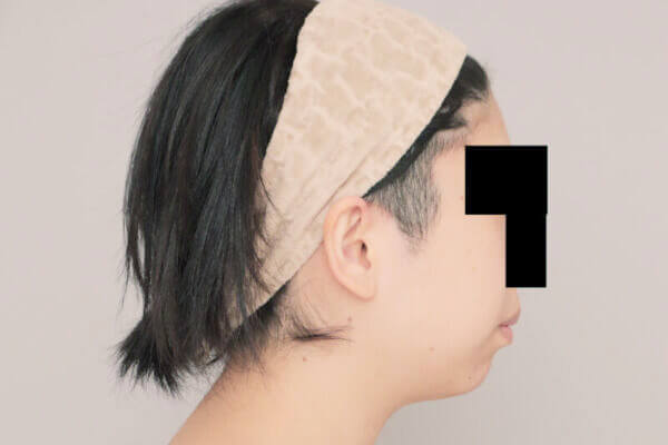 術前