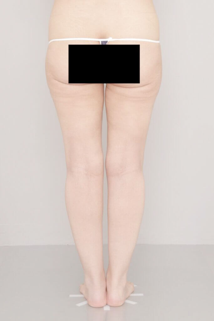 3ヶ月