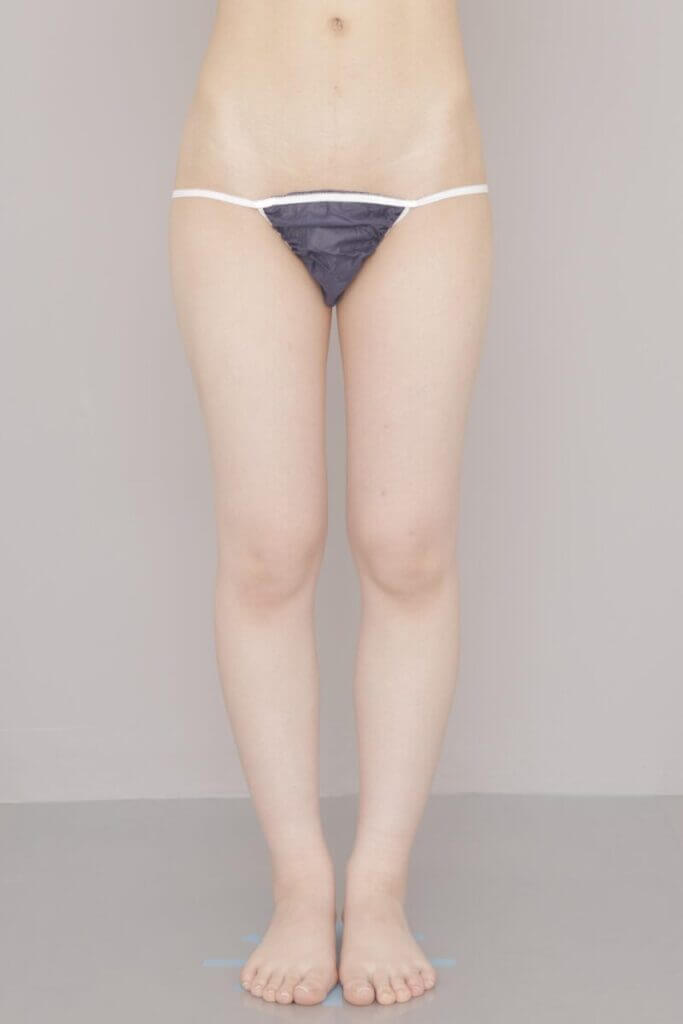 術前