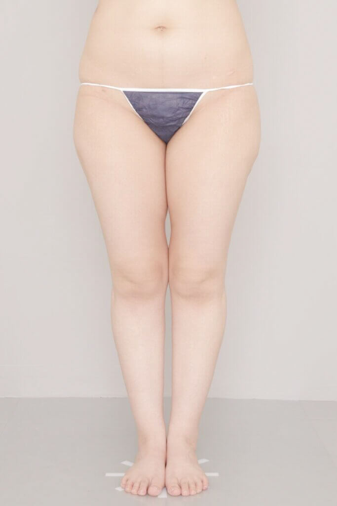 術前
