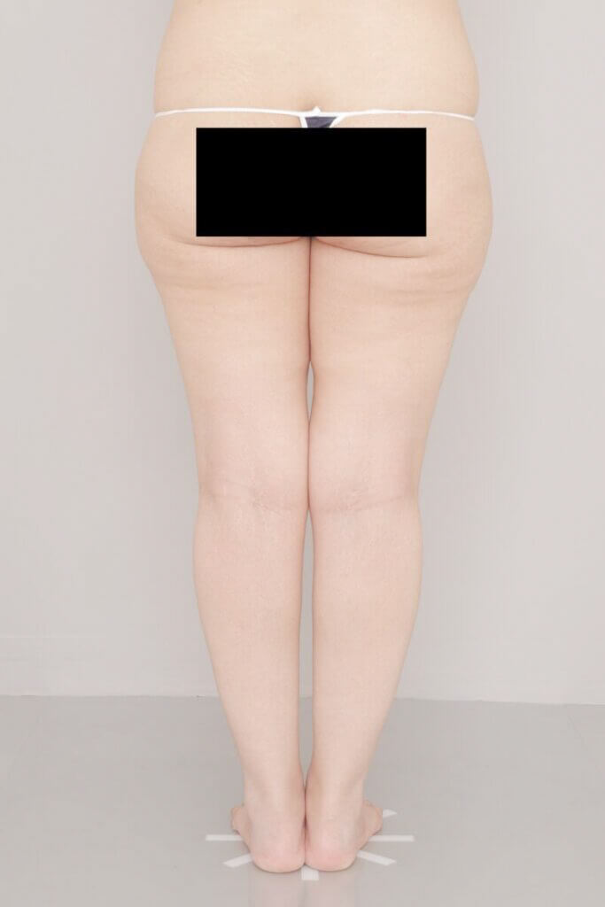 術前